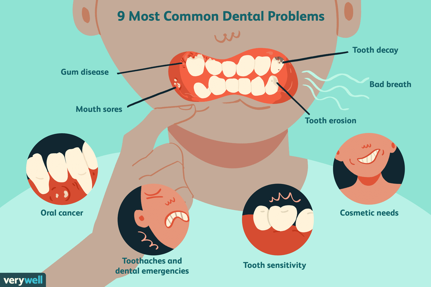 5 Common Dental Problems and Treatment